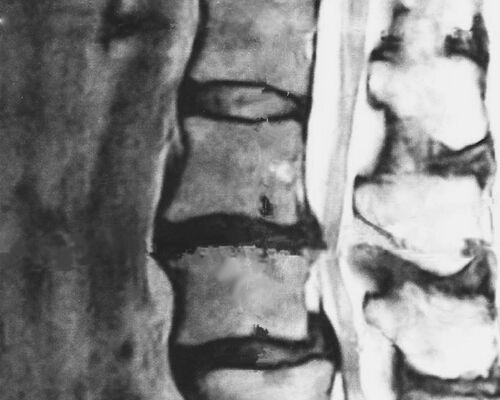 マシンピラティス